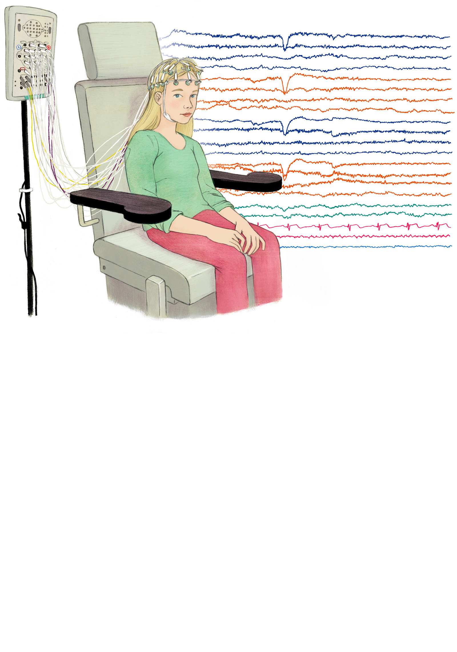 oculus-illustration-epilepsie_eeg