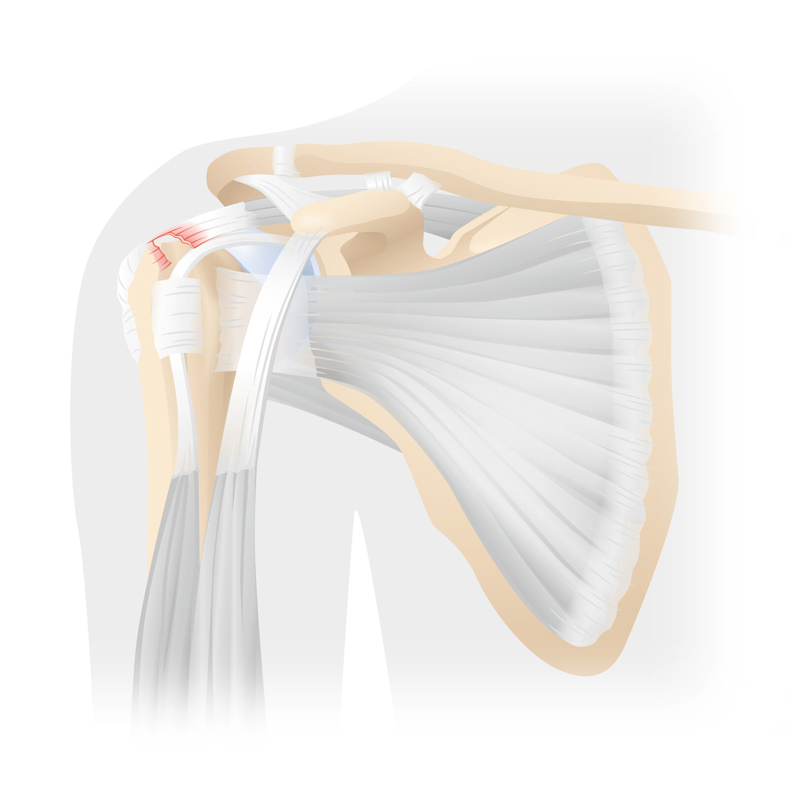 oculus-illustration-medizin-gelenkchirurgie-schulter-anatomie