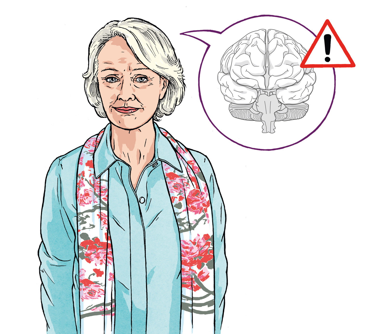 oculus-illustration-patientenkarte-schlaganfall