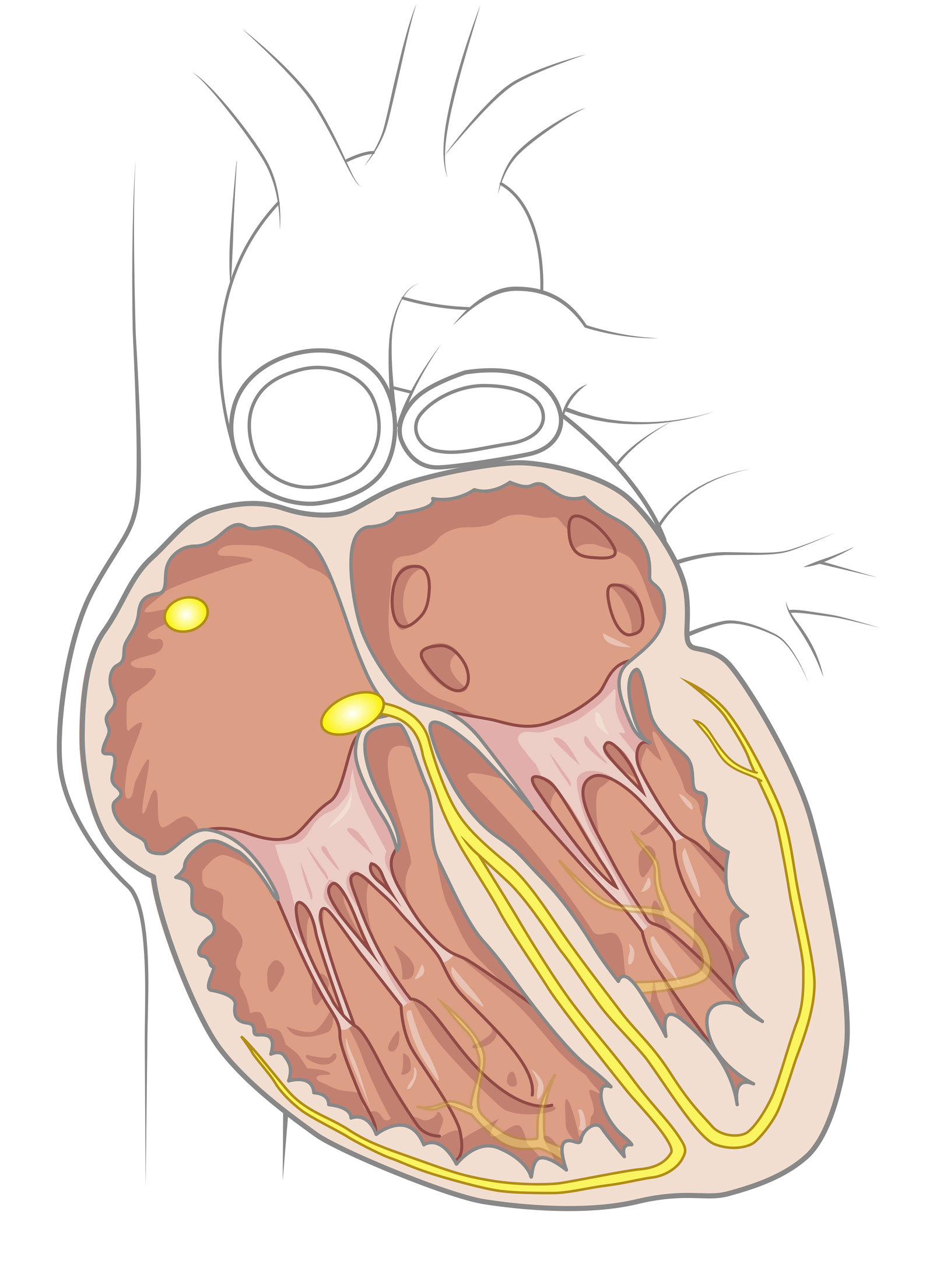 oculus-illustration-spital-herz-kardiologie-reizleitungssystem