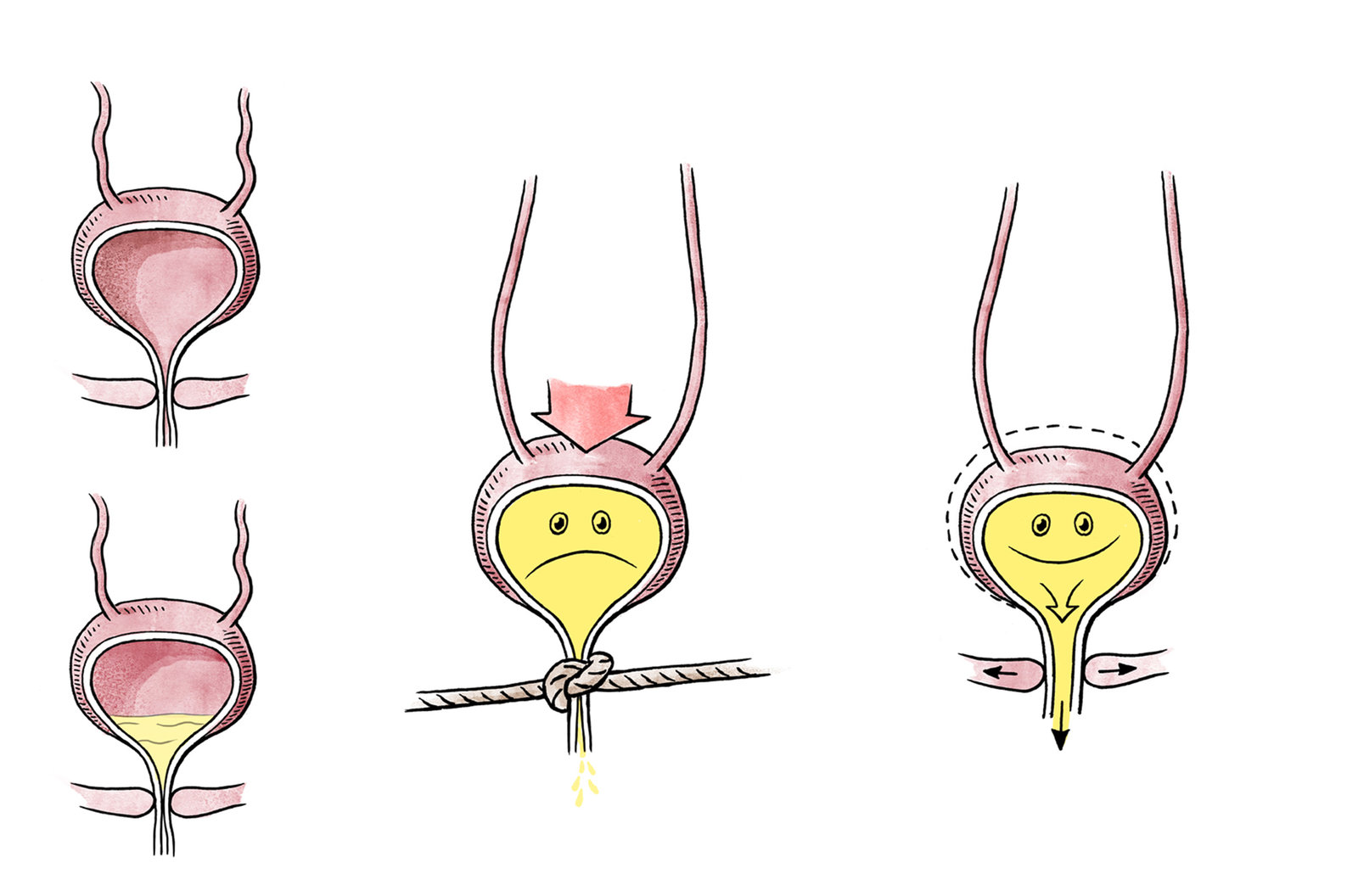 oculus-illustration-urologie-kinder-zeichnung-blasenentleerung