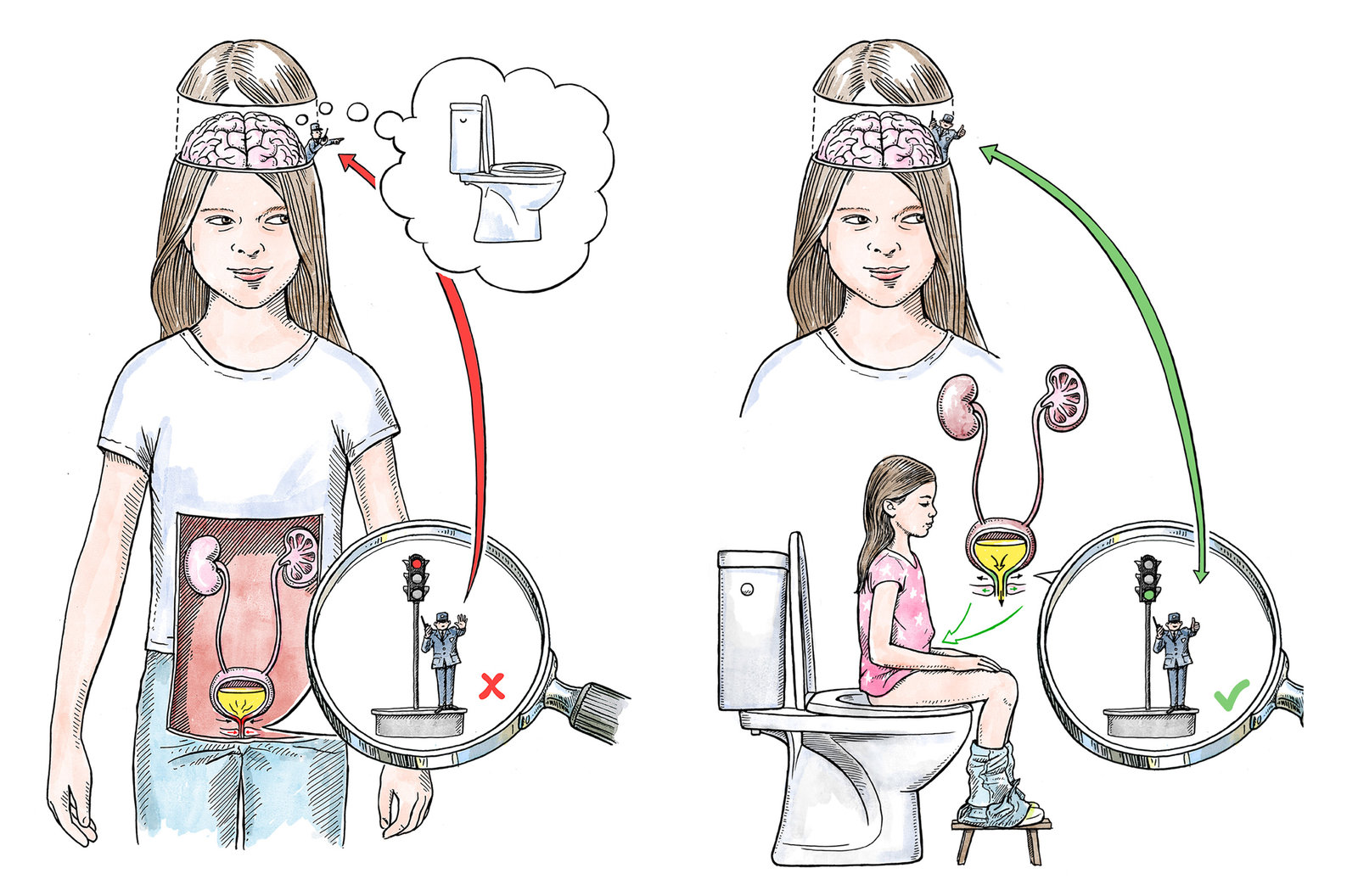 oculus-illustration-urologie-kinder-zeichnung-signal-blase-gehirn