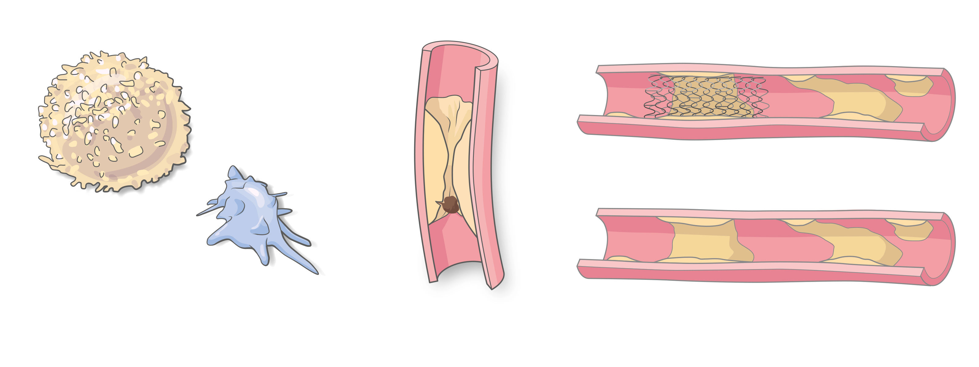 oculus-illustration-medizin-thombozyten-trombose