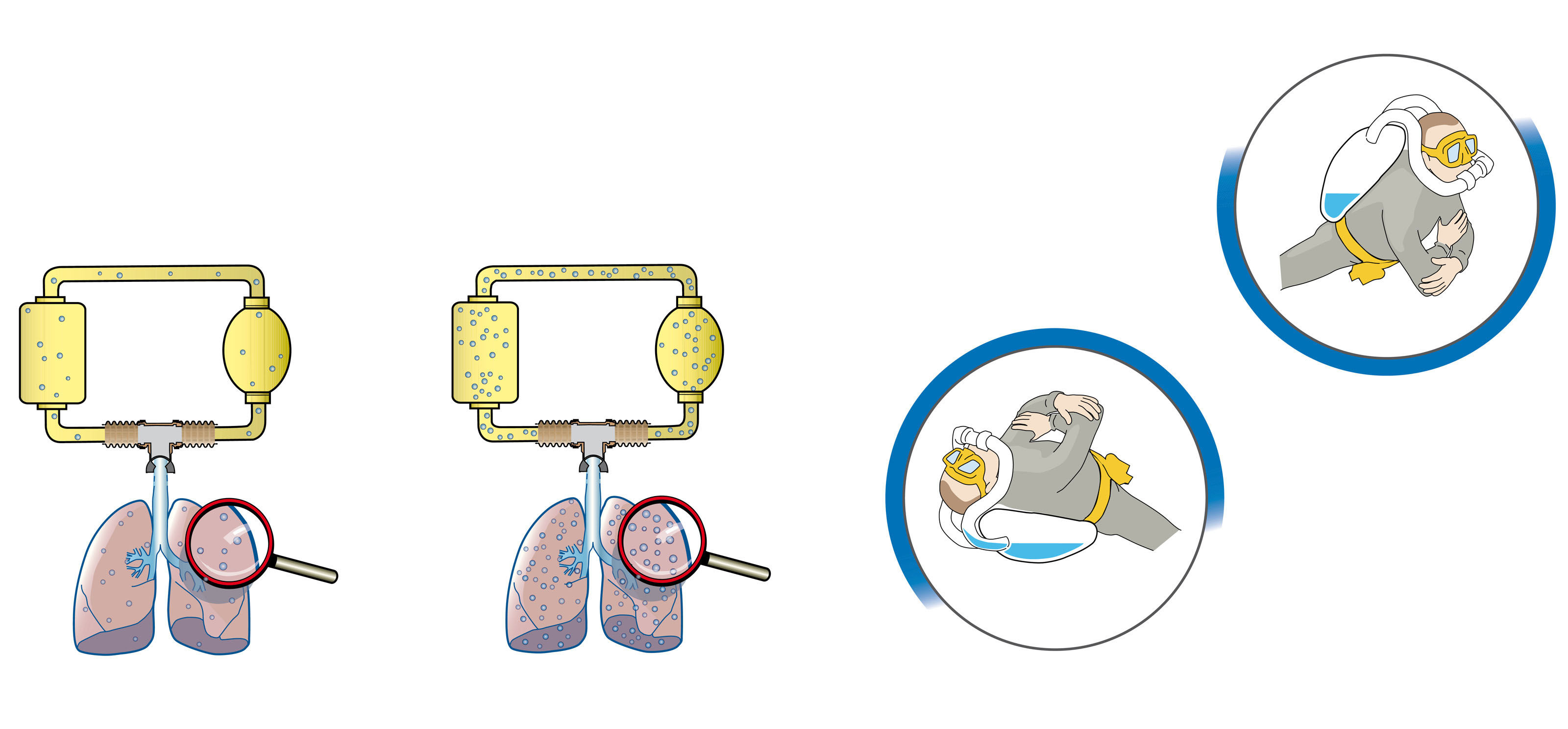 oculus-illustration-natur-rebreather-tauchen-kreislaufgeraeten-medizinische-aspekte-lunge-hypoxie-kalkbehaelter-atemkreislauf