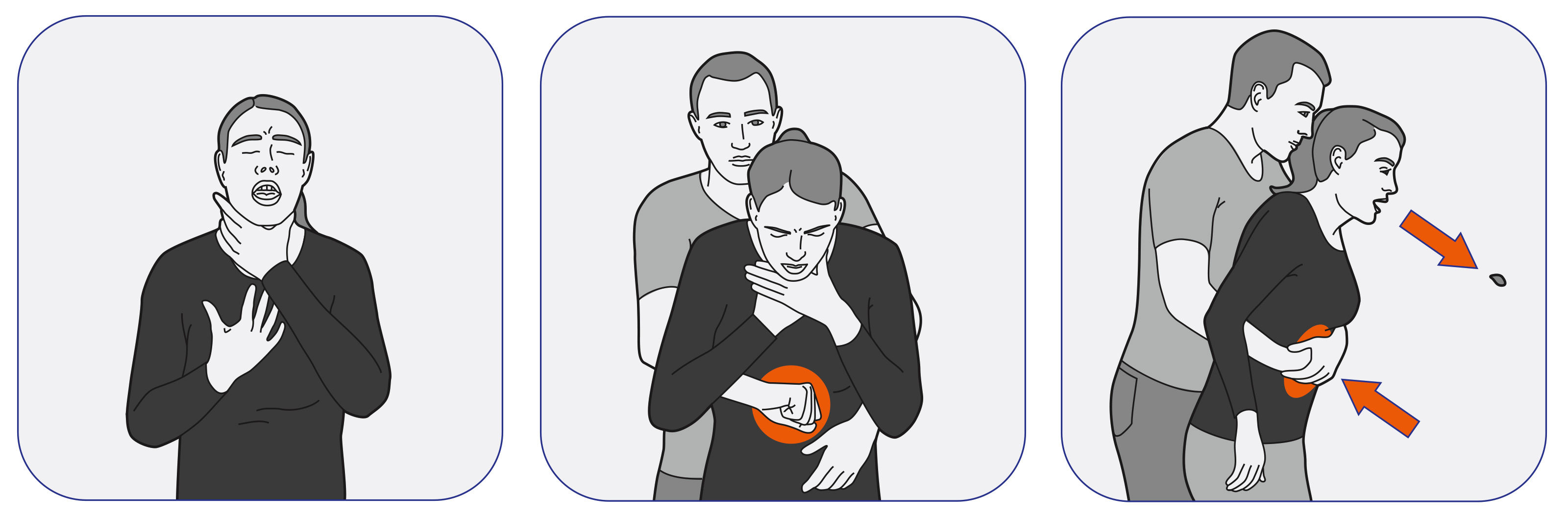 oculus-illustration-vektor-helsana-ratgeber-heimlich-griff